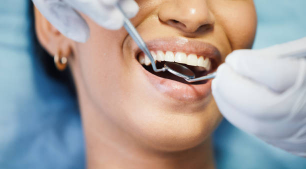 Best Urgent Care for Lost Fillings or Crowns in New Freedom, PA